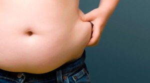 obesitas