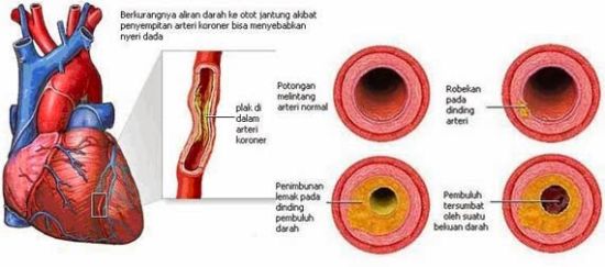 9. ciri ciri lemah jantung