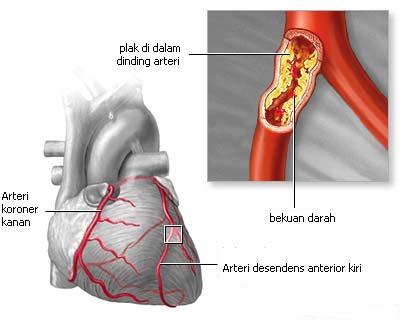 kelainan jantung dini