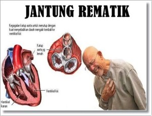 jantung rematik