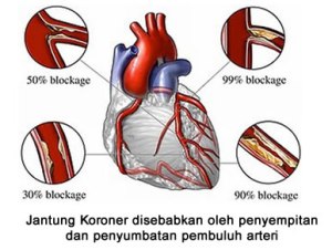 jantung koroner