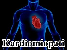 Kardiomiopati