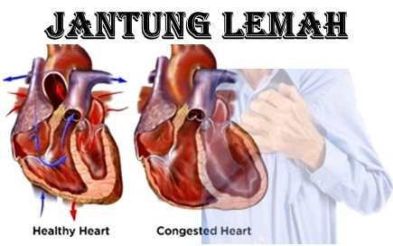 13. ciri jantung lemah 2