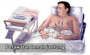 lemah jantung