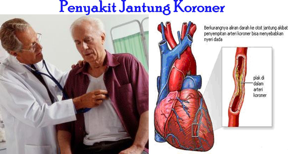 Mencegah penyakit jantung